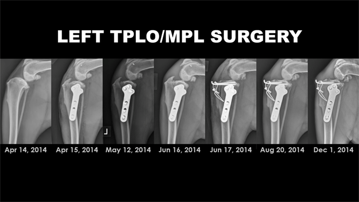 CBLO Surgery Complications: Lightning Bolt's Knee Injury and Surgery Disaster - radiographs